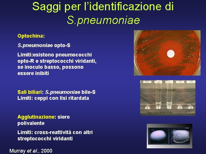 Saggi per l’identificazione di S. pneumoniae Optochina: S. pneumoniae opto-S Limiti: esistono pneumococchi opto-R