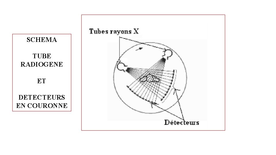 SCHEMA TUBE RADIOGENE ET DETECTEURS EN COURONNE SCHEMA TUBE RADIOGENE ET DETECTEURS EN COURONNE