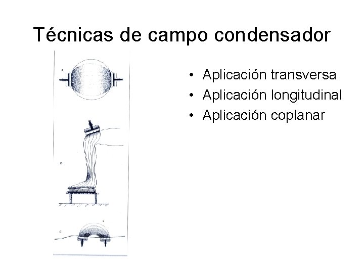 Técnicas de campo condensador • Aplicación transversa • Aplicación longitudinal • Aplicación coplanar Técnicas de campo condensador • Aplicación transversa • Aplicación longitudinal • Aplicación coplanar