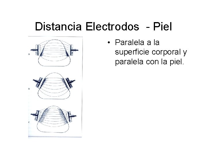 Distancia Electrodos - Piel • Paralela a la superficie corporal y paralela con la Distancia Electrodos - Piel • Paralela a la superficie corporal y paralela con la