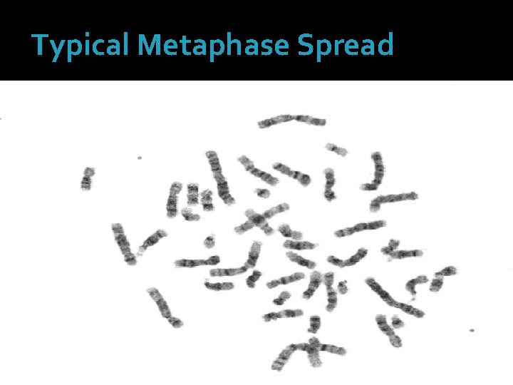 Typical Metaphase Spread 