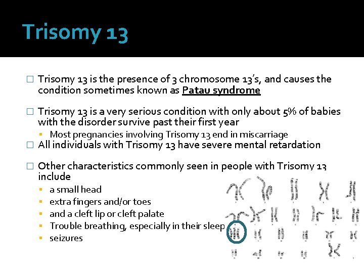 Trisomy 13 � Trisomy 13 is the presence of 3 chromosome 13’s, and causes