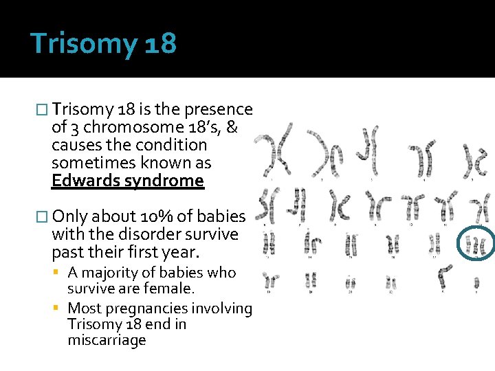 Trisomy 18 � Trisomy 18 is the presence of 3 chromosome 18’s, & causes