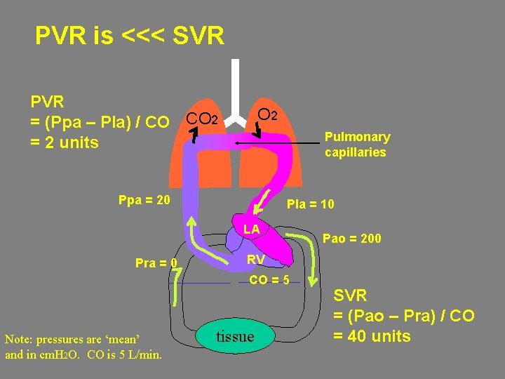 PVR is <<< SVR PVR = (Ppa – Pla) / CO CO 2 =