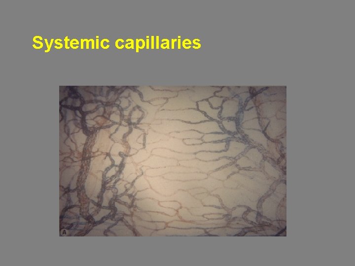 Systemic capillaries 
