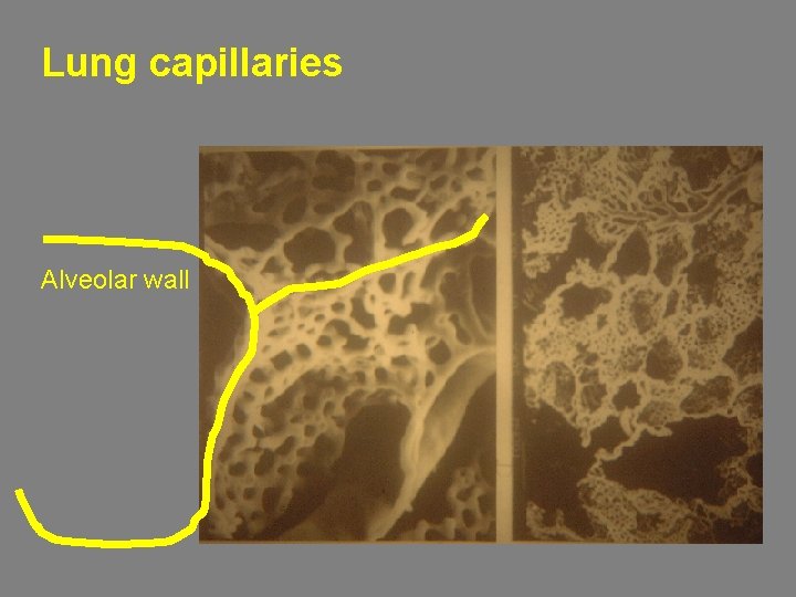 Lung capillaries Alveolar wall 