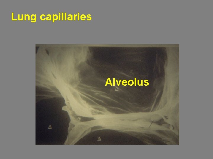 Lung capillaries Alveolus 