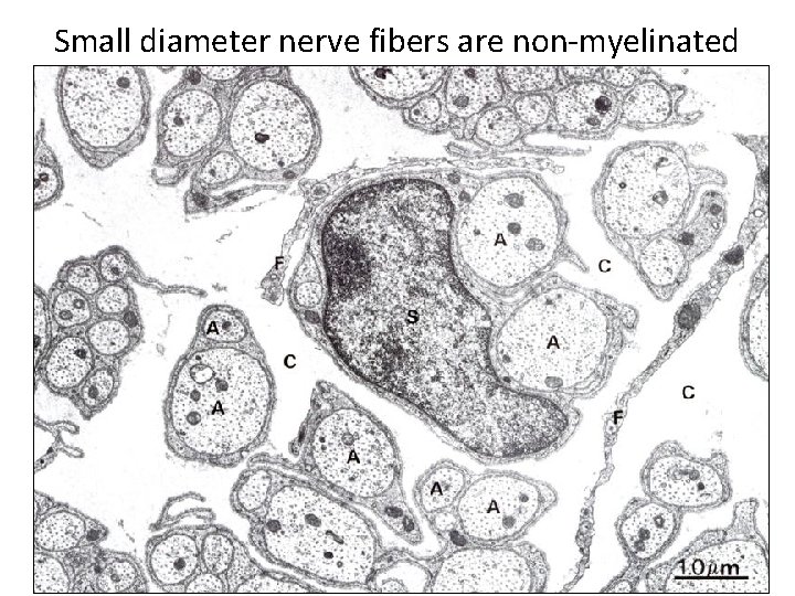 Small diameter nerve fibers are non-myelinated 