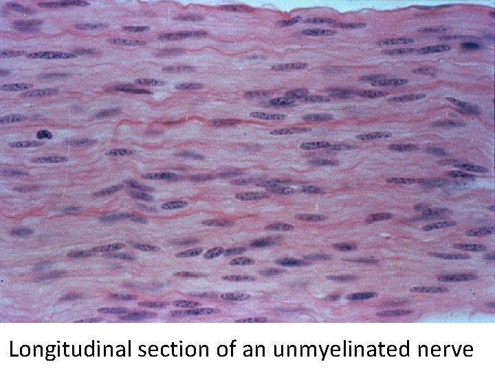 Longitudinal section of an unmyelinated nerve 