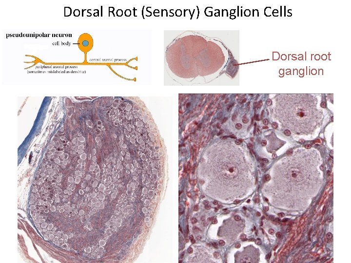 Dorsal Root (Sensory) Ganglion Cells Dorsal root ganglion 