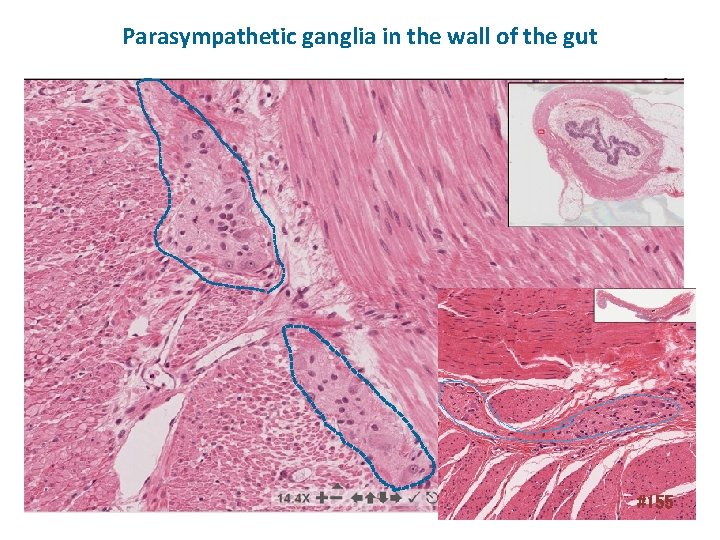 Parasympathetic ganglia in the wall of the gut #155 
