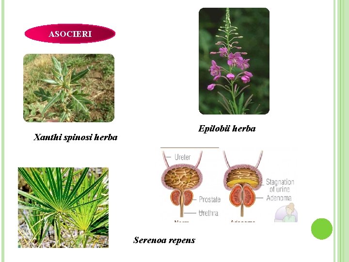 ASOCIERI Epilobii herba Xanthi spinosi herba Serenoa repens 