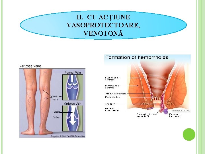 II. CU ACŢIUNE VASOPROTECTOARE, VENOTONĂ 