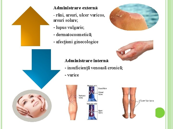 Administrare externă - răni, arsuri, ulcer varicos, arsuri solare; - lupus vulgaris; - dermatocosmetică;