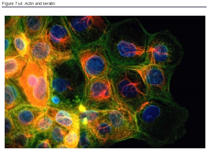 Figure 7. x 4 Actin and keratin 