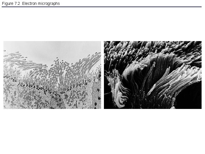 Figure 7. 2 Electron micrographs 