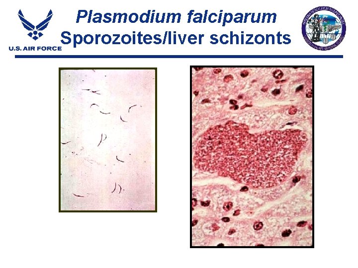 Plasmodium falciparum Sporozoites/liver schizonts Plasmodium falciparum Sporozoites/liver schizonts