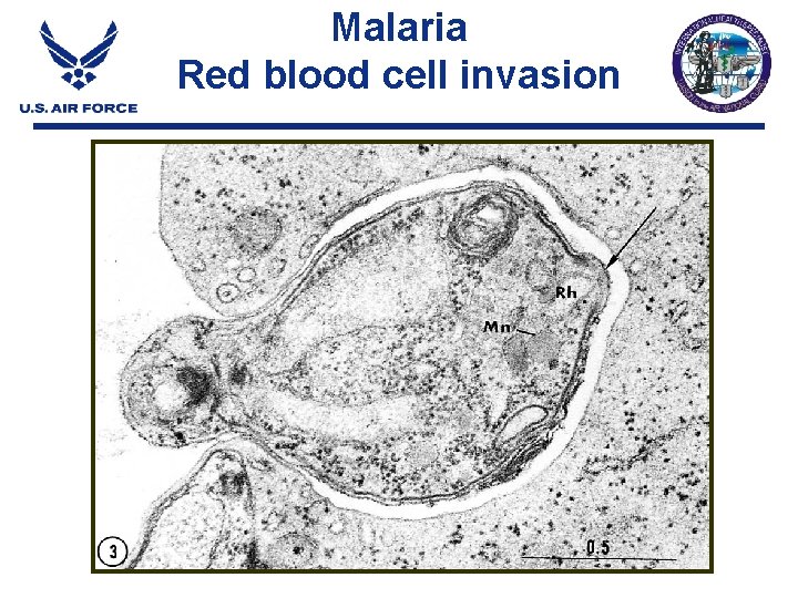 Malaria Red blood cell invasion Malaria Red blood cell invasion