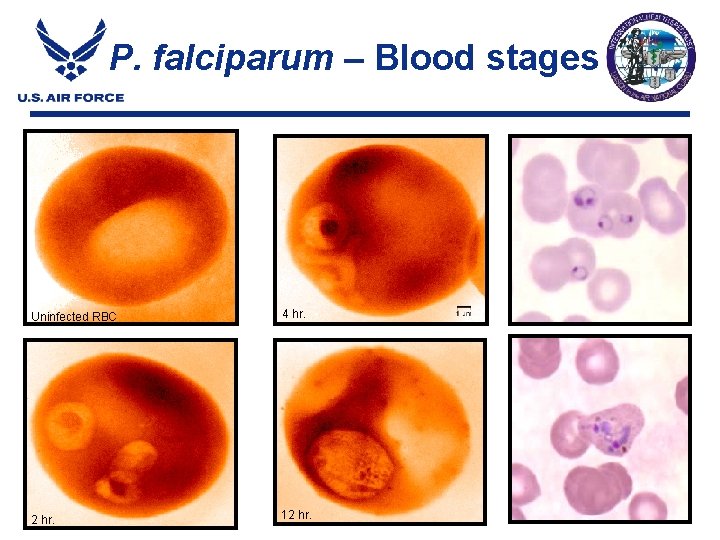 P. falciparum – Blood stages Uninfected RBC 4 hr. 2 hr. 12 hr. P. falciparum – Blood stages Uninfected RBC 4 hr. 2 hr. 12 hr.