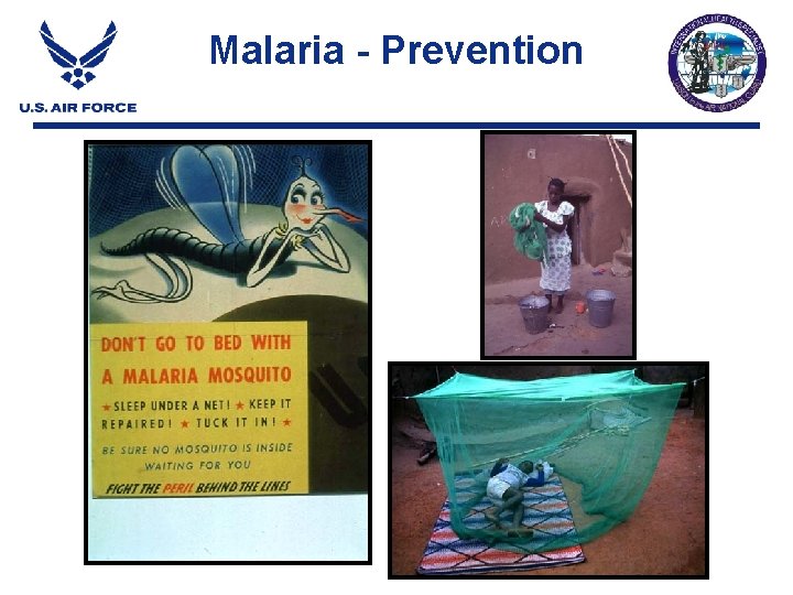 Malaria - Prevention Malaria - Prevention