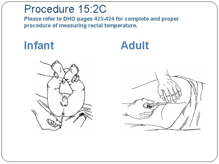 Procedure 15: 2 C Please refer to DHO pages 423 -424 for complete and