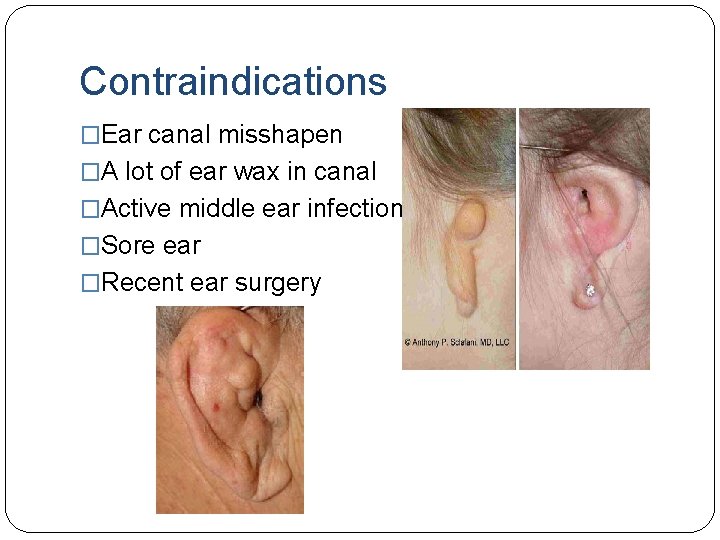 Contraindications �Ear canal misshapen �A lot of ear wax in canal �Active middle ear