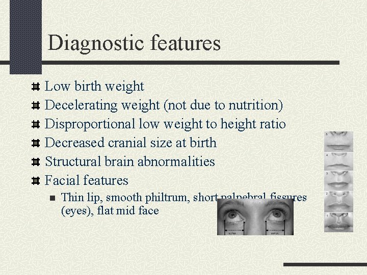 Diagnostic features Low birth weight Decelerating weight (not due to nutrition) Disproportional low weight