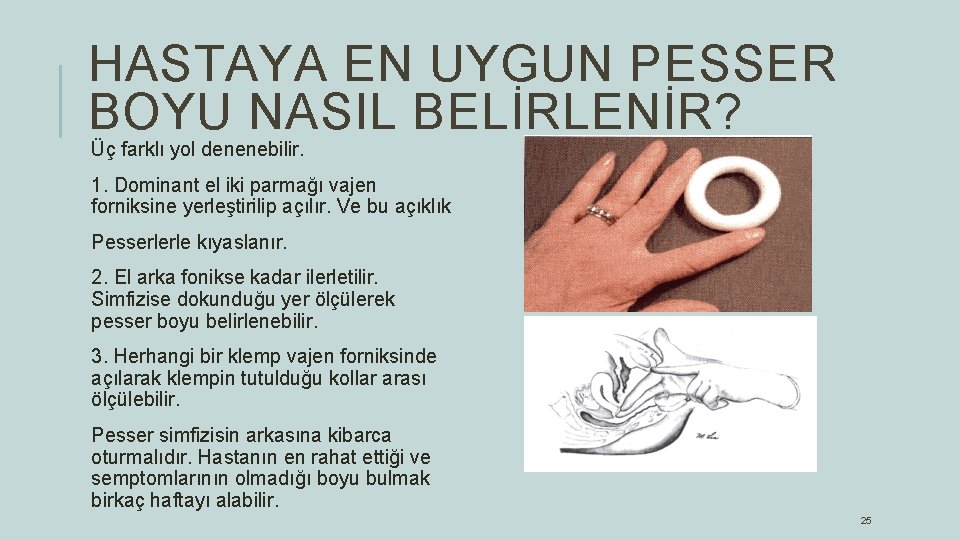 HASTAYA EN UYGUN PESSER BOYU NASIL BELİRLENİR? Üç farklı yol denenebilir. 1. Dominant el