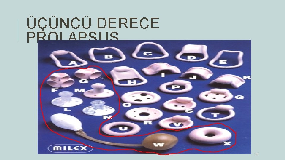 ÜÇÜNCÜ DERECE PROLAPSUS 27 