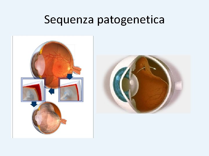 Sequenza patogenetica 