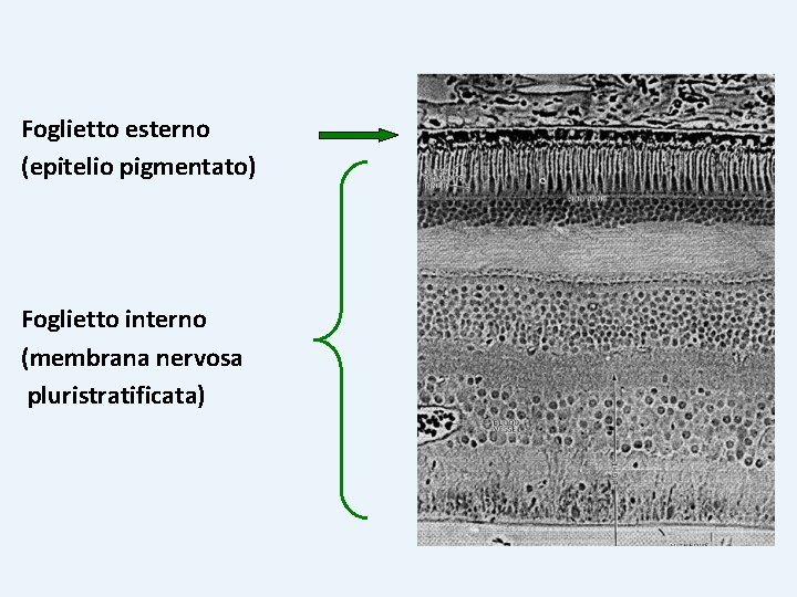 Foglietto esterno (epitelio pigmentato) Foglietto interno (membrana nervosa pluristratificata) 