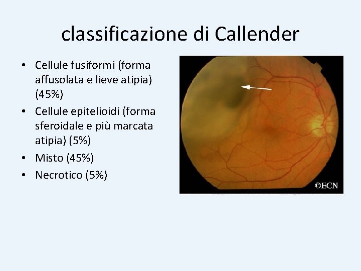 classificazione di Callender • Cellule fusiformi (forma affusolata e lieve atipia) (45%) • Cellule