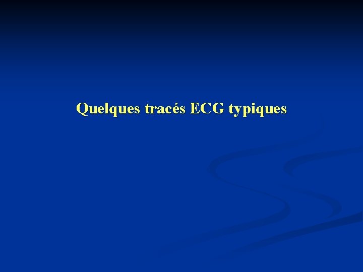 Quelques tracés ECG typiques 