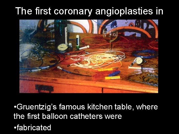 The first coronary angioplasties in Zurich • Gruentzig’s famous kitchen table, where the first