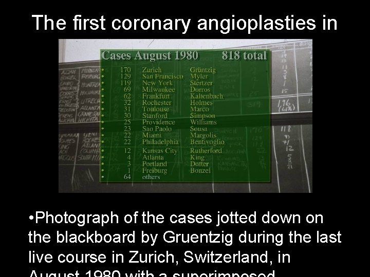 The first coronary angioplasties in Zurich • Photograph of the cases jotted down on