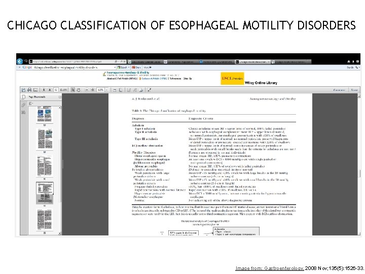 CHICAGO CLASSIFICATION OF ESOPHAGEAL MOTILITY DISORDERS 21 Image from: Gastroenterology. 2008 Nov; 135(5): 1526