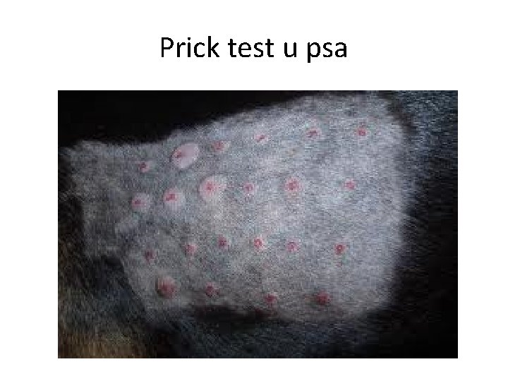 Prick test u psa 