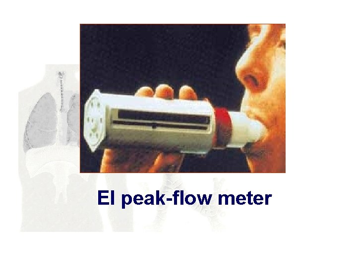 El peak-flow meter 