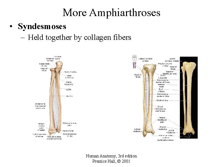 More Amphiarthroses • Syndesmoses – Held together by collagen fibers Human Anatomy, 3 rd