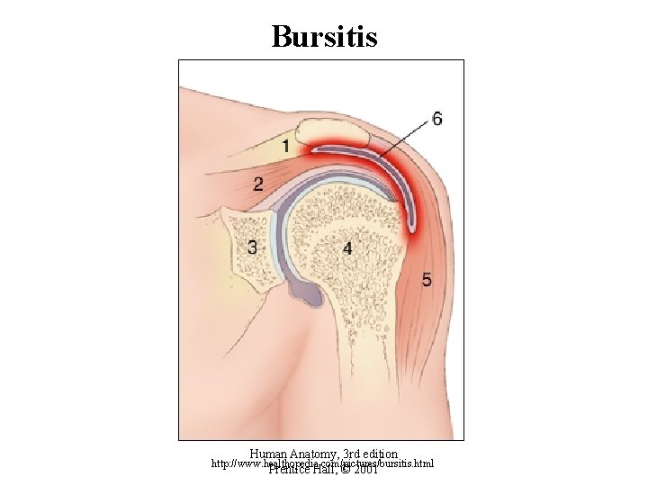 Bursitis Human Anatomy, 3 rd edition Prentice Hall, © 2001 http: //www. healthopedia. com/pictures/bursitis.