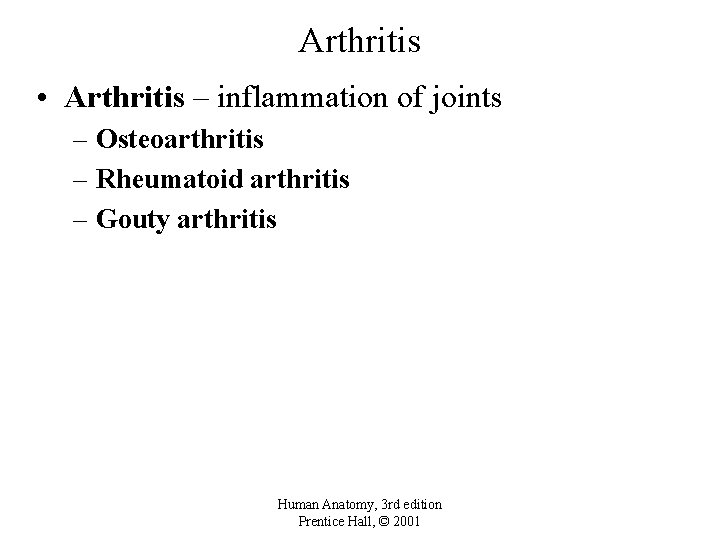 Arthritis • Arthritis – inflammation of joints – Osteoarthritis – Rheumatoid arthritis – Gouty