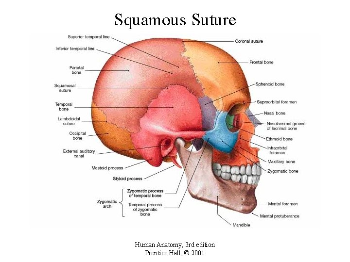 Squamous Suture Human Anatomy, 3 rd edition Prentice Hall, © 2001 