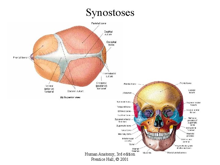 Synostoses Human Anatomy, 3 rd edition Prentice Hall, © 2001 