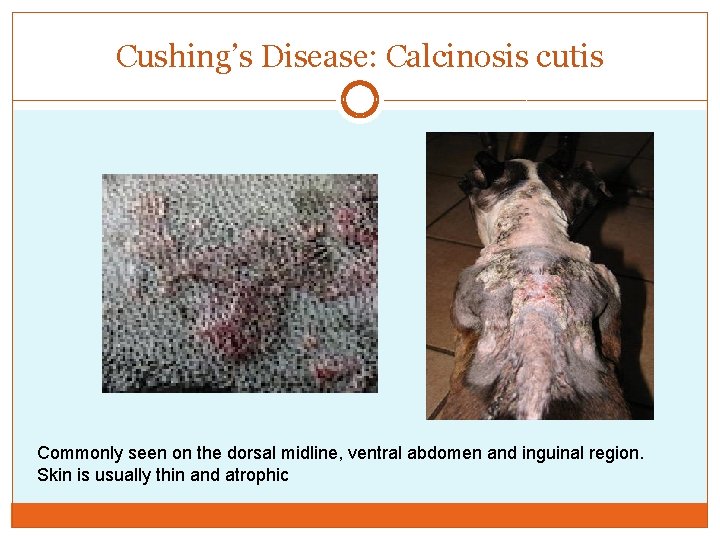 Cushing’s Disease: Calcinosis cutis Commonly seen on the dorsal midline, ventral abdomen and inguinal