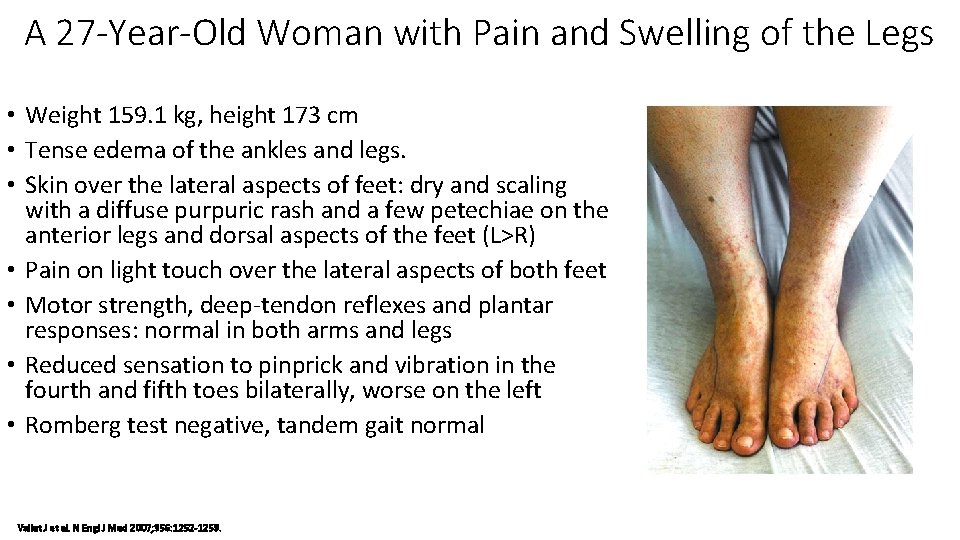 A 27 -Year-Old Woman with Pain and Swelling of the Legs • Weight 159.