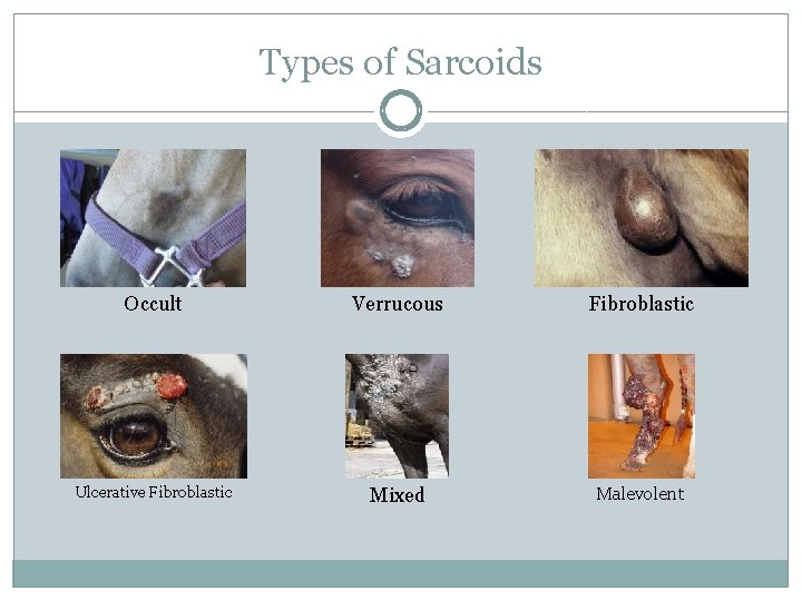 Types of Sarcoids Occult Verrucous Fibroblastic Ulcerative Fibroblastic Mixed Malevolent 