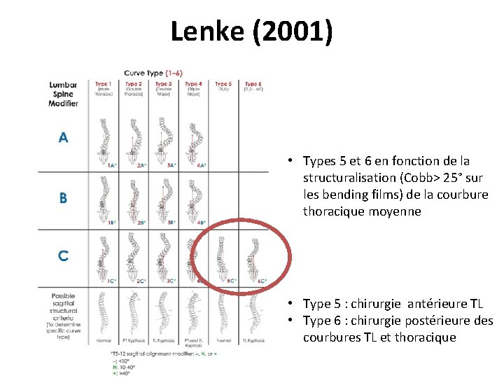 Lenke (2001) • Types 5 et 6 en fonction de la structuralisation (Cobb> 25°