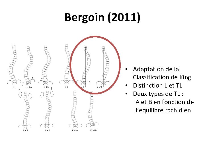 Bergoin (2011) • Adaptation de la Classification de King • Distinction L et TL