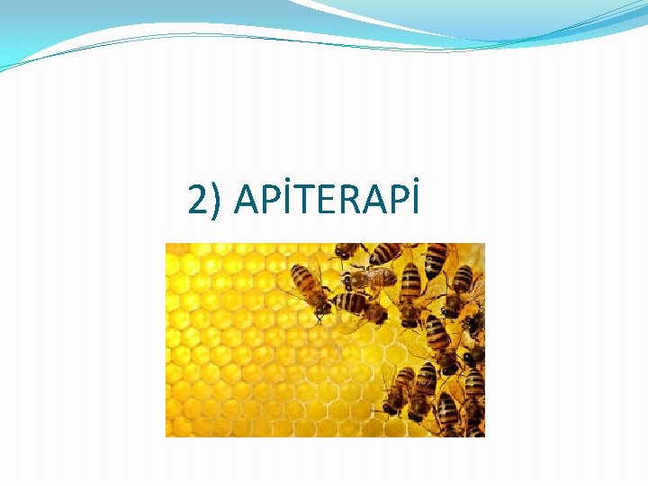 2) APİTERAPİ 