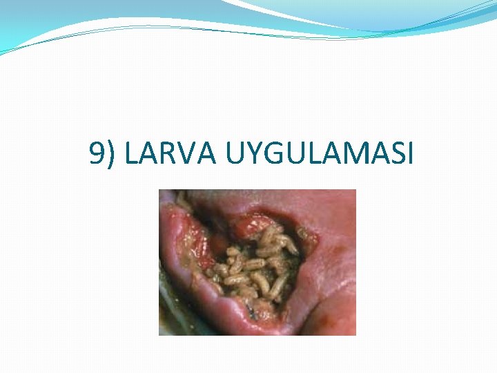 9) LARVA UYGULAMASI 